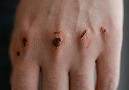 夢見創傷 ：7 個意義和象徵