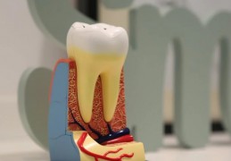 夢見牙齒脫落的 9 個夢境解釋：夢見因蛀牙而感到疼痛 、夢見治療蛀牙