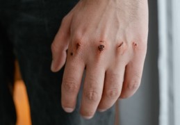 夢見被刀割傷是什麼意思？意義和象徵、心理狀態、情境解讀