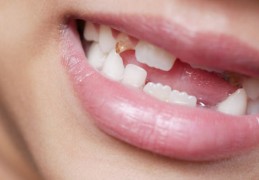 夢見下排牙齒掉落是什麼意思？意義和象徵、心理狀態、情境解讀