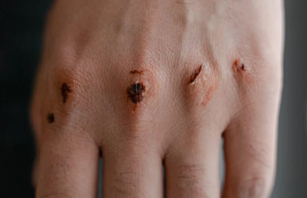 夢見創傷 ：7 個意義和象徵