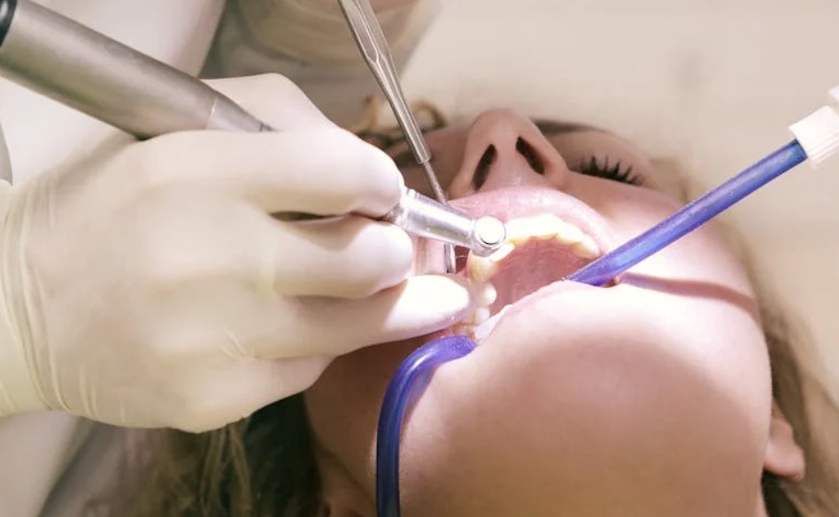 夢見治療蛀牙的 9 個夢境解釋：夢見完全蛀牙治療、夢見牙醫不小心傷到蛀牙